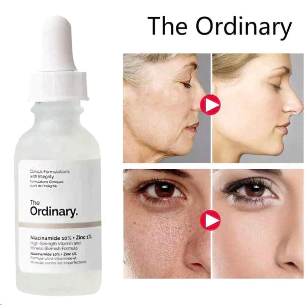 The Ordinary Niacinamide 10% + Zinc 1% Face Serum Canada Imported